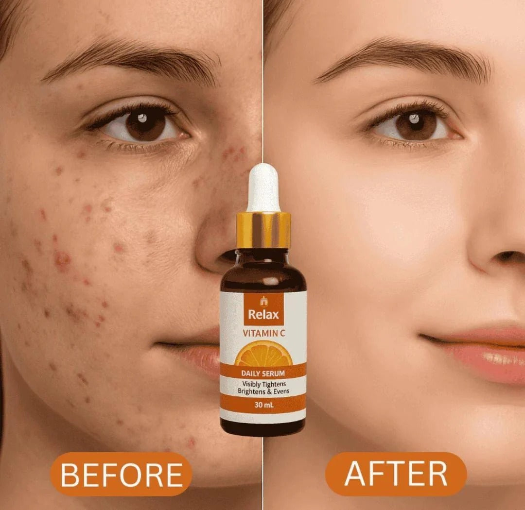 Relax Vitamin C Brightening Serum 30ml